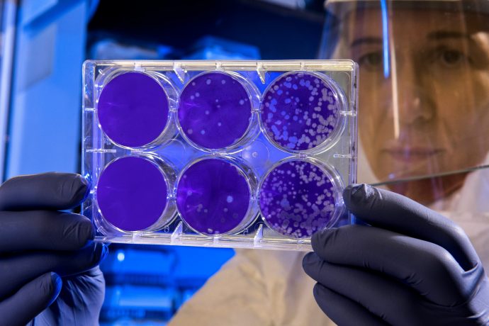 ジェルネイルでグリーンネイルになる 大人の虫歯は危険がいっぱい 爪も歯も健康でいたい ネイル女子 Have A Nice Day Tomorrow ジェルネイルでグリーンネイルになる 大人の虫歯は危険がいっぱい 爪も歯も健康でいたい ネイル女子 Have A Nice Day Tomorrow