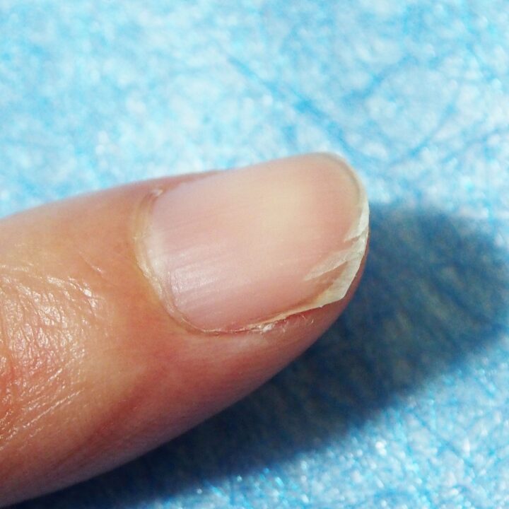 二枚爪でもジェルネイルしていいの？原因と対策・補強の方法を解説