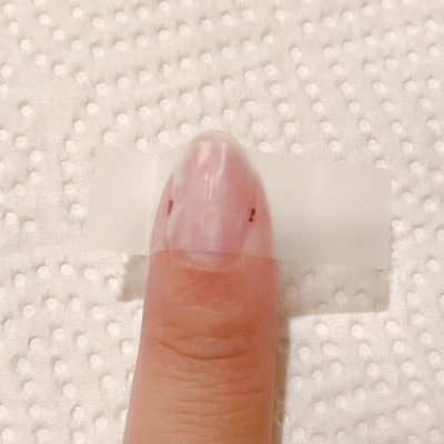 テープを使って爪の横幅を測っている写真