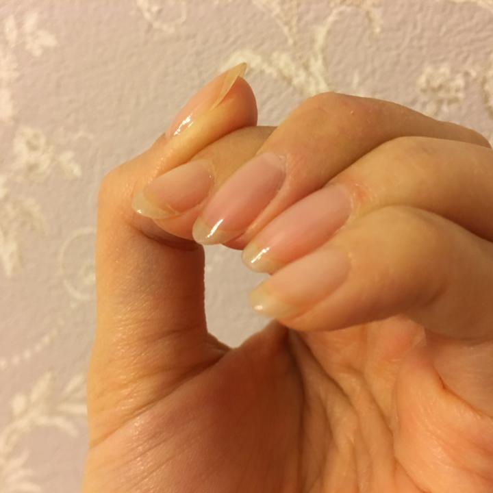 【自宅で簡単】爪のストレスポイントに亀裂が！その原因とセルフでできる簡単補修方法