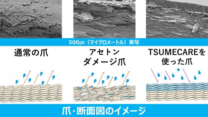 傷んでしまった爪のイメージ図