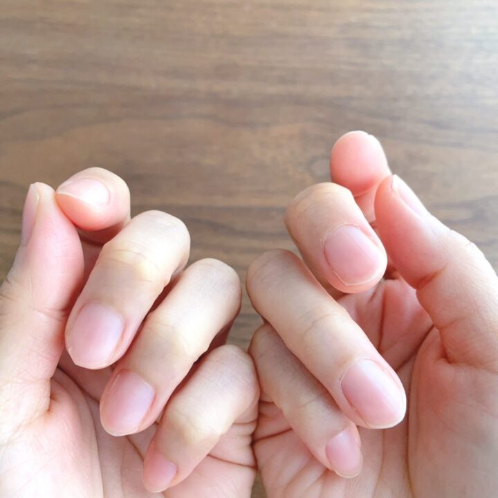 爪がふにゃふにゃになった！原因はジェルネイルのせい？爪を守る方法と補強のやり方