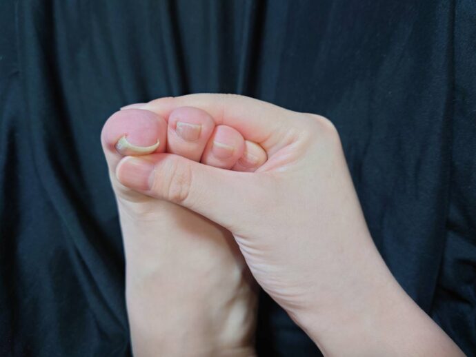 爪を確認する様子