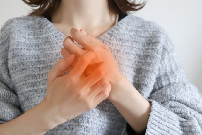 手が痒い女性のイメージ図