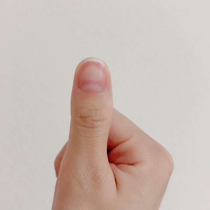 爪がサイドウォールまで白くなっている！両脇まで白い理由と改善方法は？